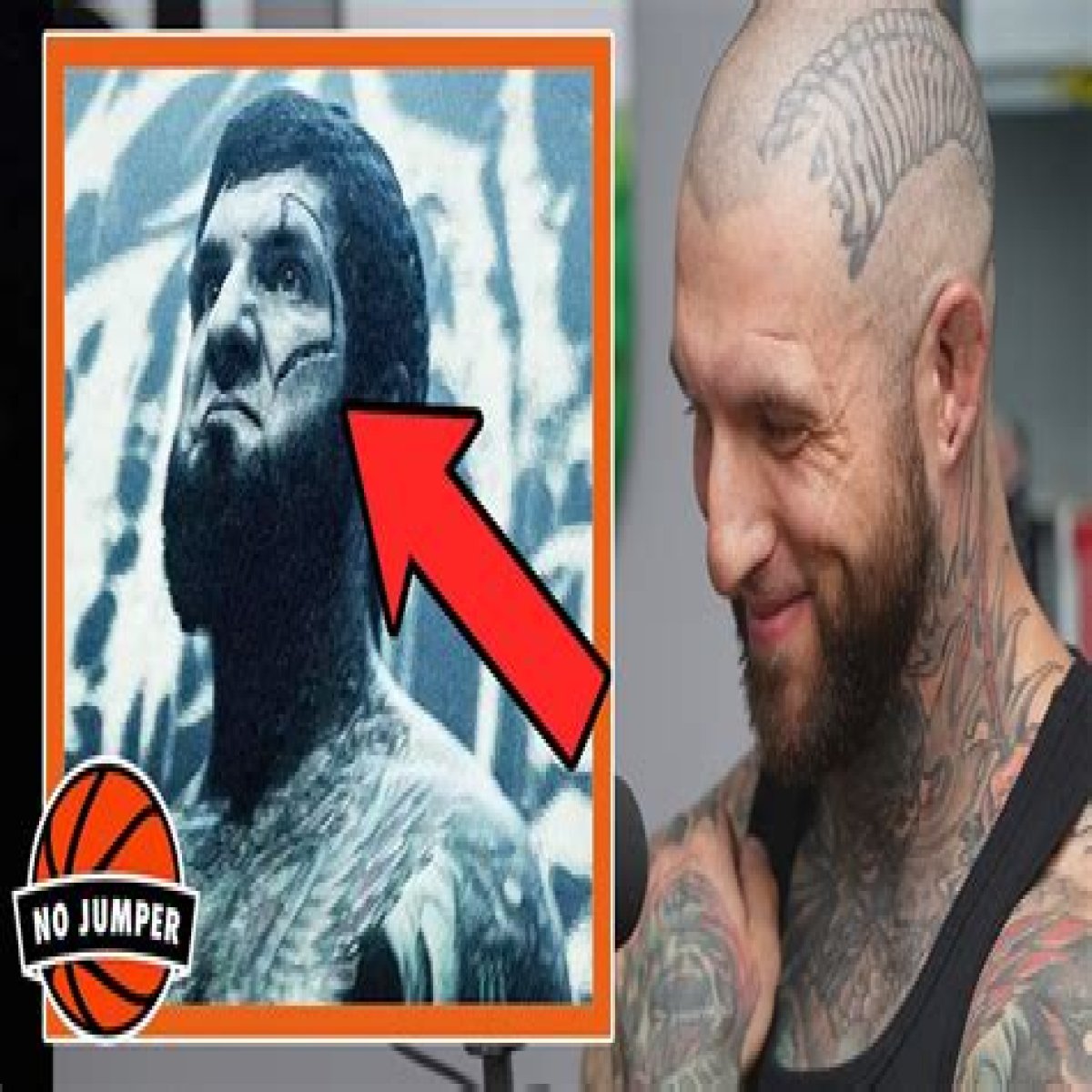How Did Alex Terrible Get Scar On Face
