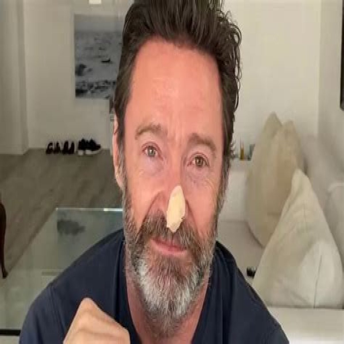 Hugh Jackman Reveals a Skin Cancer Scare